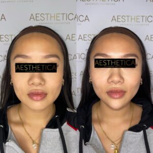BA-Facial-Balancing.jpg