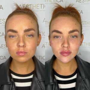 BA-Facial-Balancing-x2.jpg