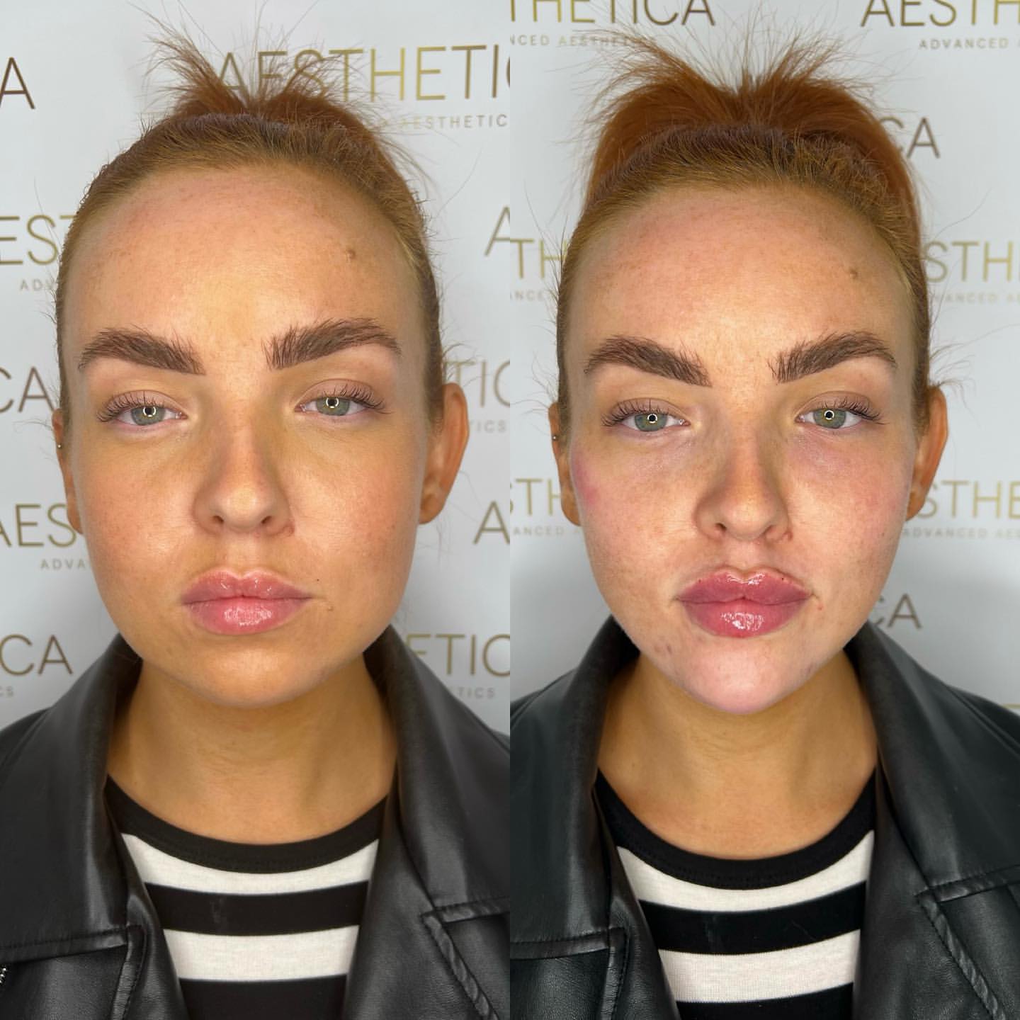 BA-Facial-Balancing-x2.jpg