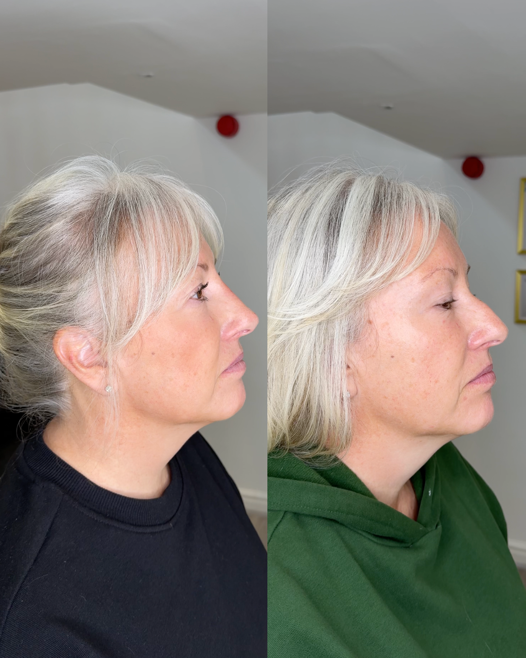 B&A - Profile Balancing 40s Page Hero