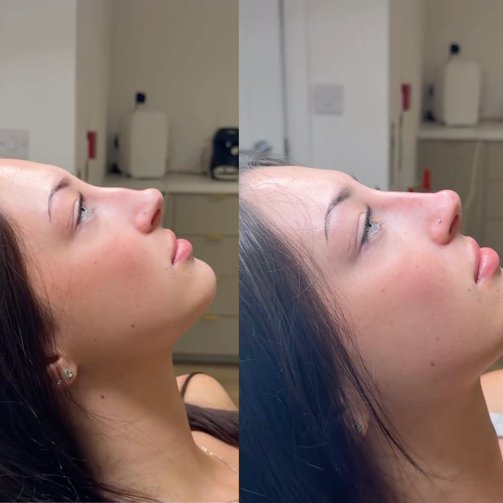 Image-Aesthetica-Nose-Filler-Ad.png