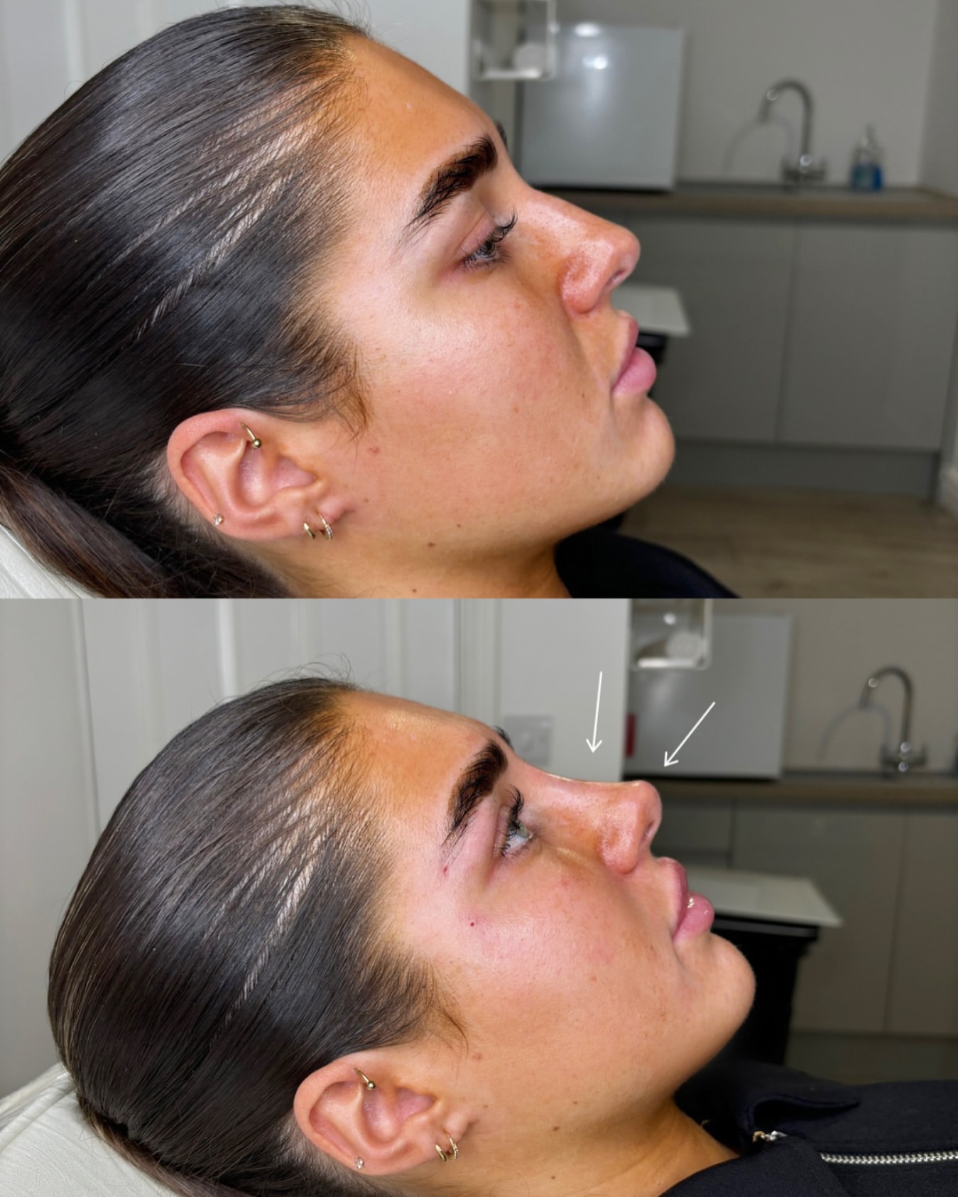 Image-Big-Straight-Into-Projected-Nose.jpg