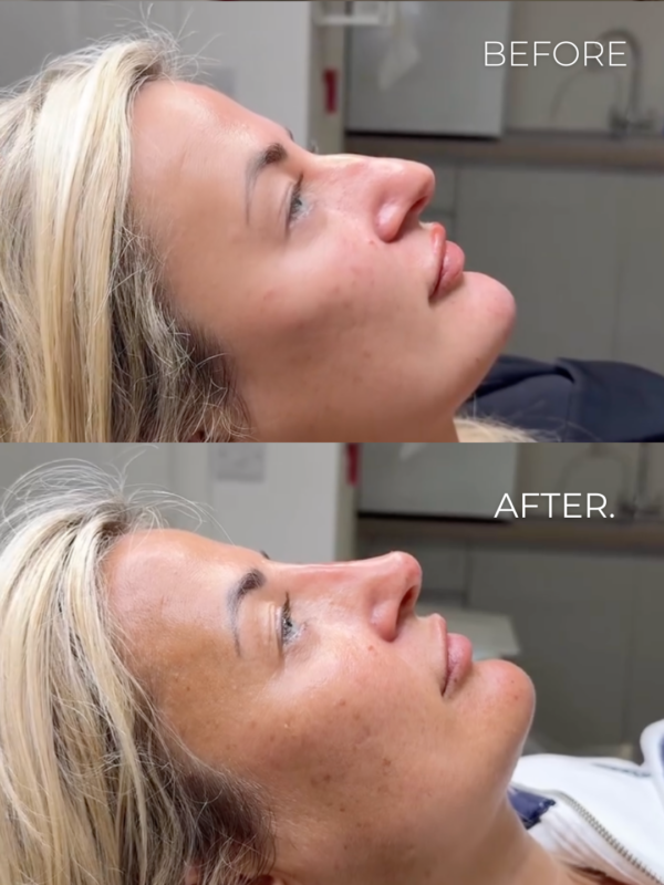 Image - Changing Confidence - B&A