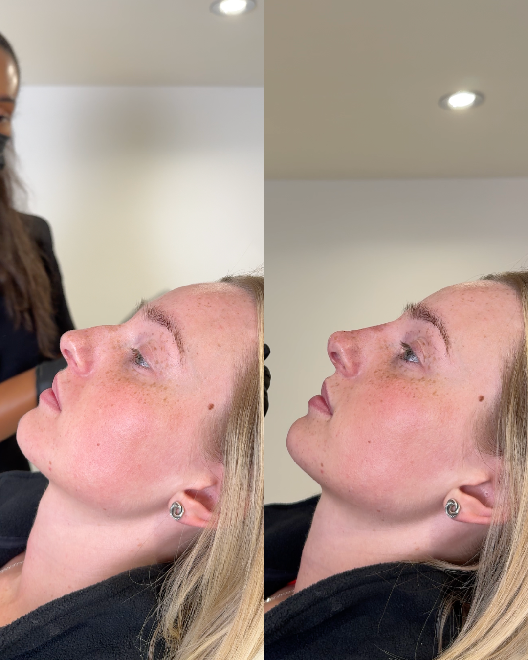 Small Curve Refined - B&A Nose