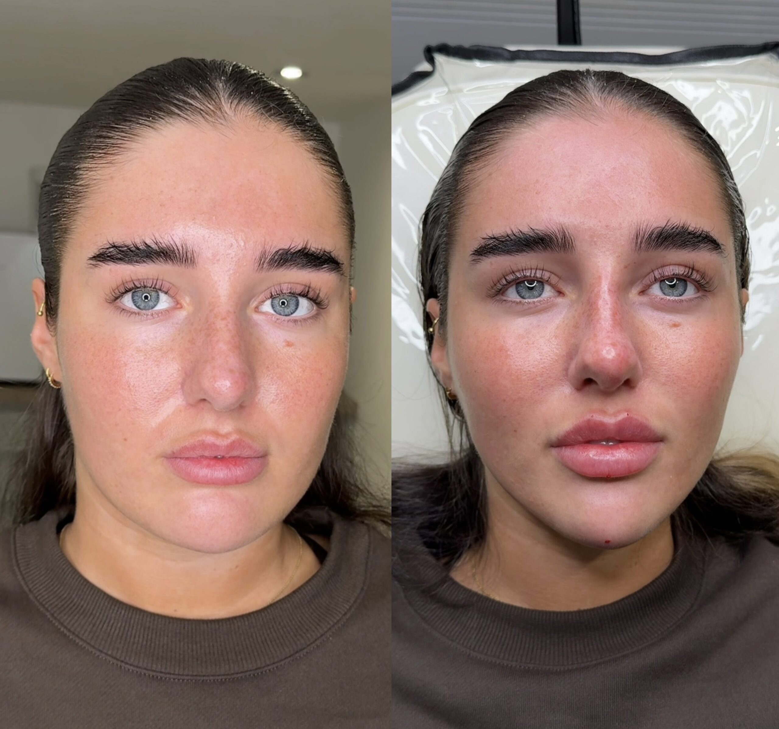 Aesthetica premium aesthetics clinic in Leeds