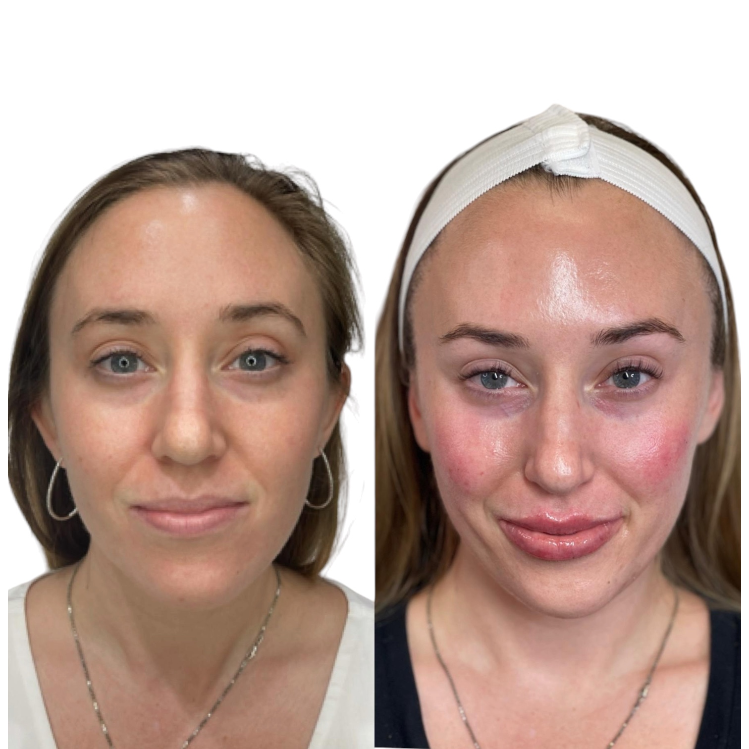 Aesthetica beauty treatments in Leeds