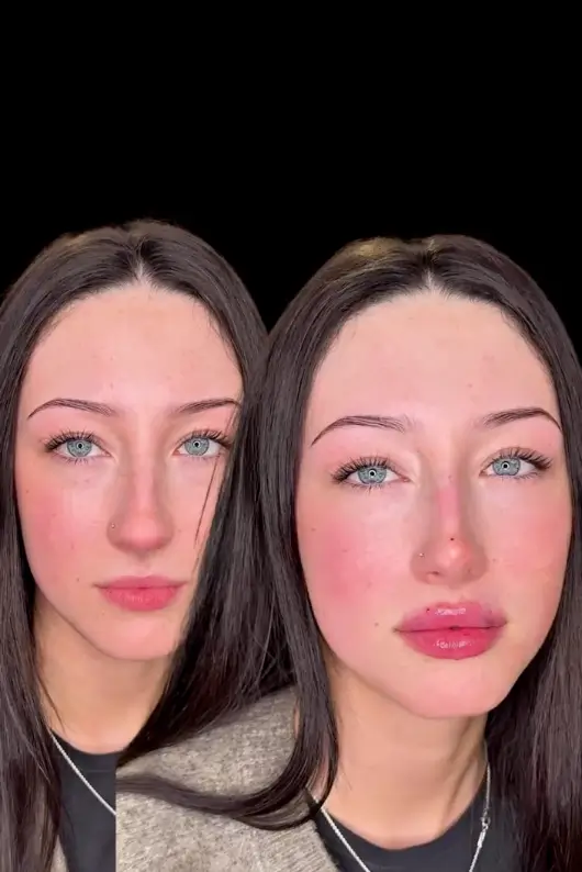 facial_balance_B&A